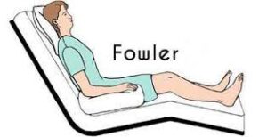 posição de fowler
